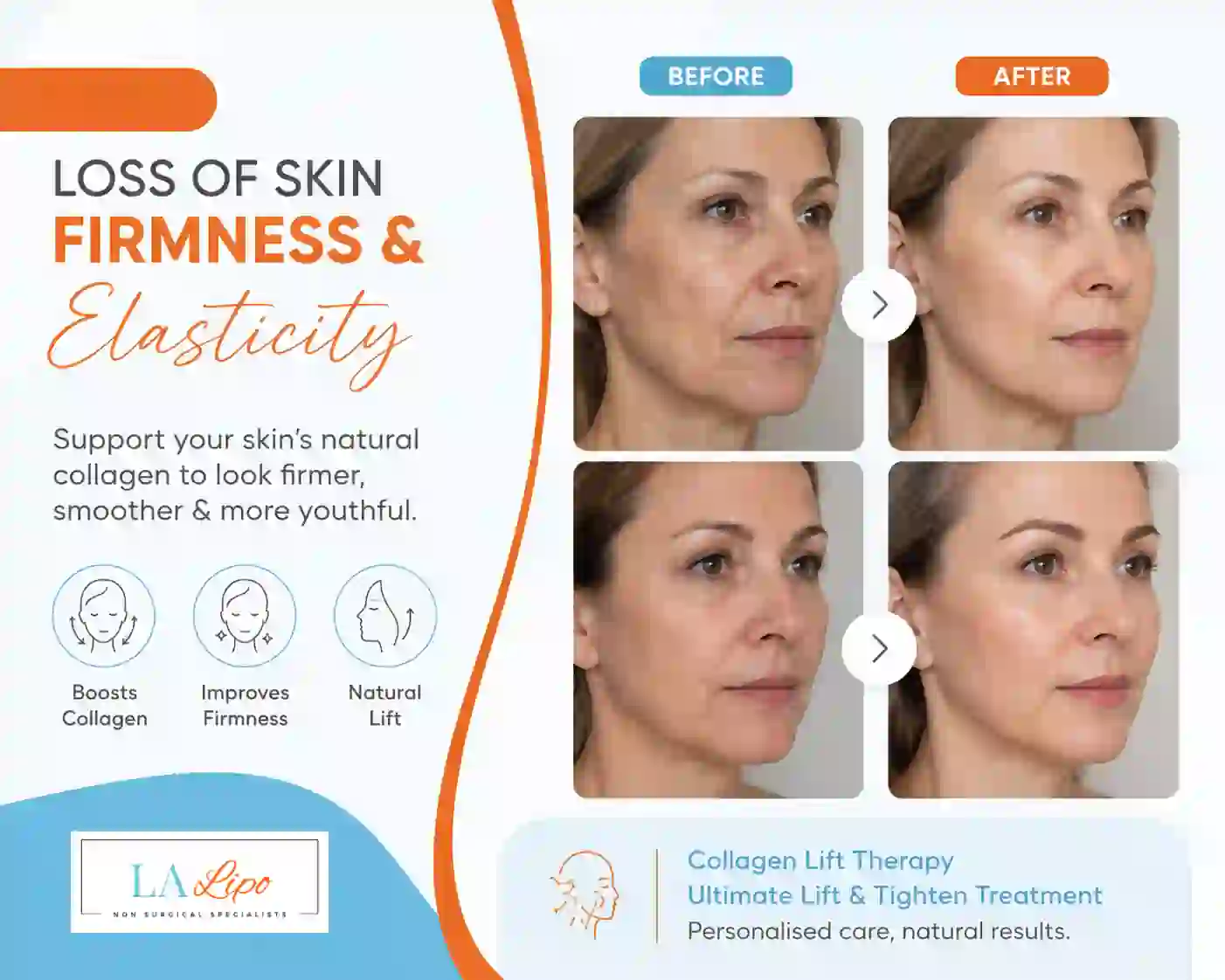 Sign #7: Loss of Skin Firmness and Elasticity Parsons Green