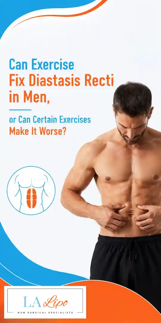 Can Exercise Fix Diastasis Recti in Men, or Can Certain Exercises Make It Worse Parsons Green?